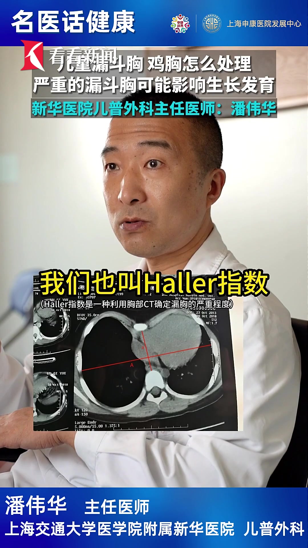 漏斗胸鸡胸如何处理