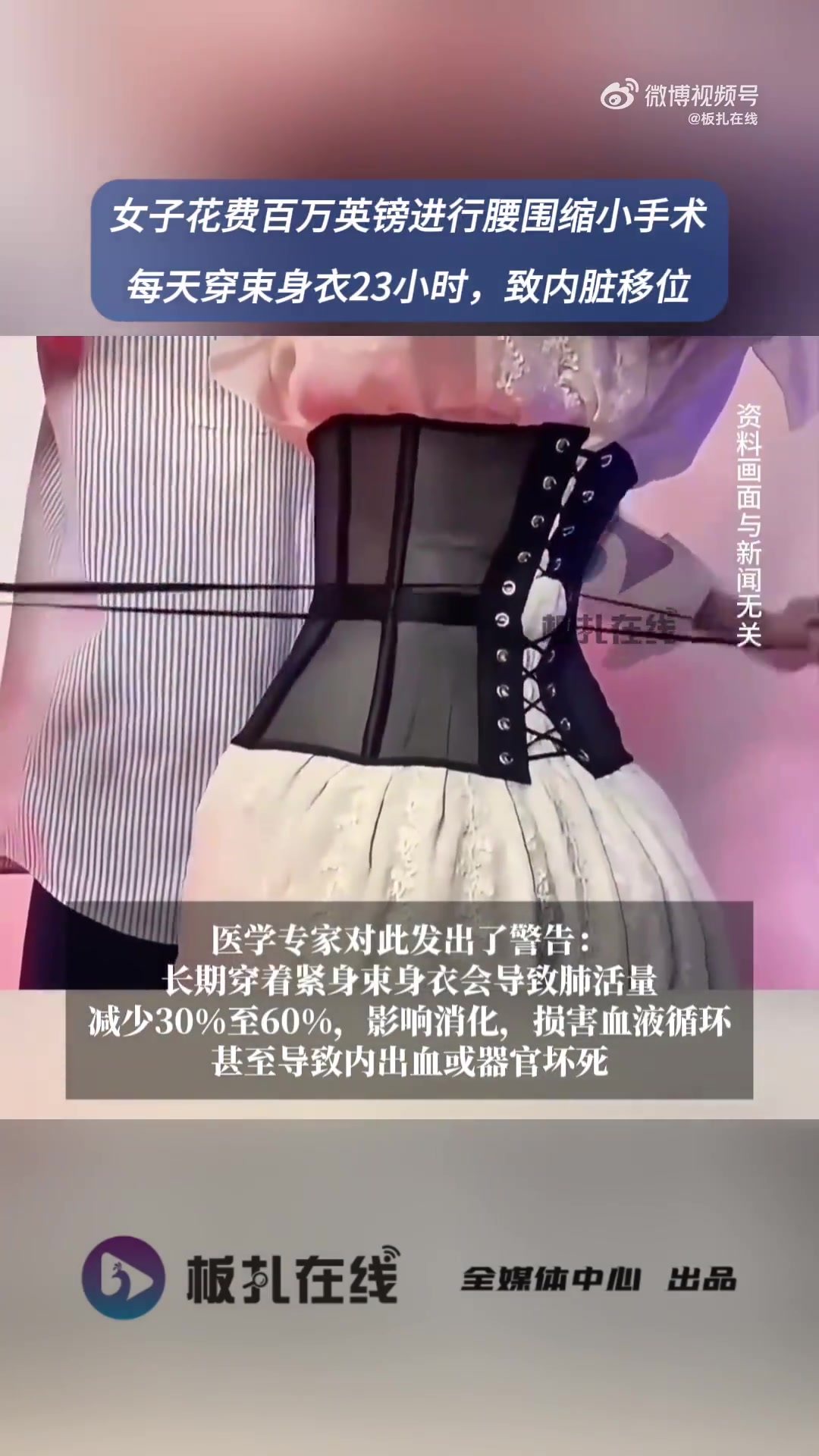 据媒体报道,居住在美国佛州的33岁委内瑞拉模特阿莱拉几乎每天穿束身衣达23小时,并花费10