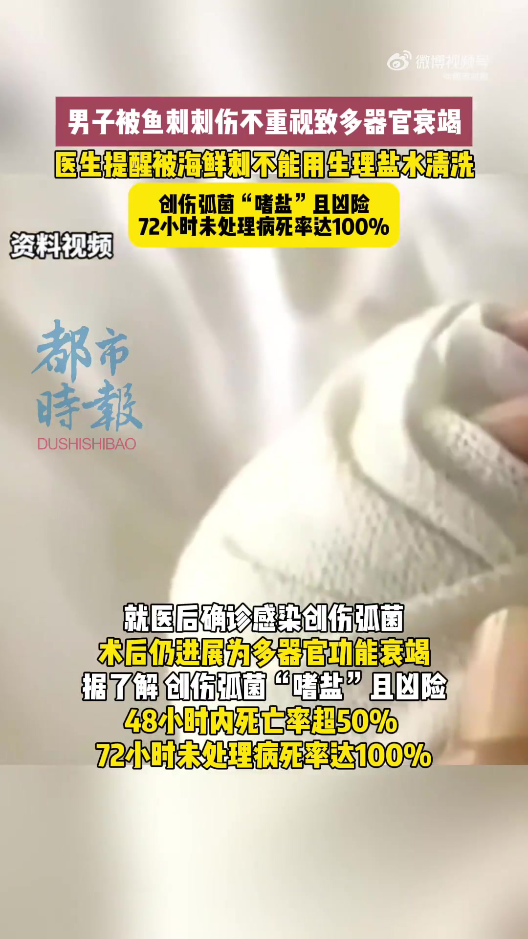 近日,广东深圳。张先生处理叉尾鮰鱼时,左手食指被鱼刺刺伤未重视。忍数日后,手指青紫肿胀、手