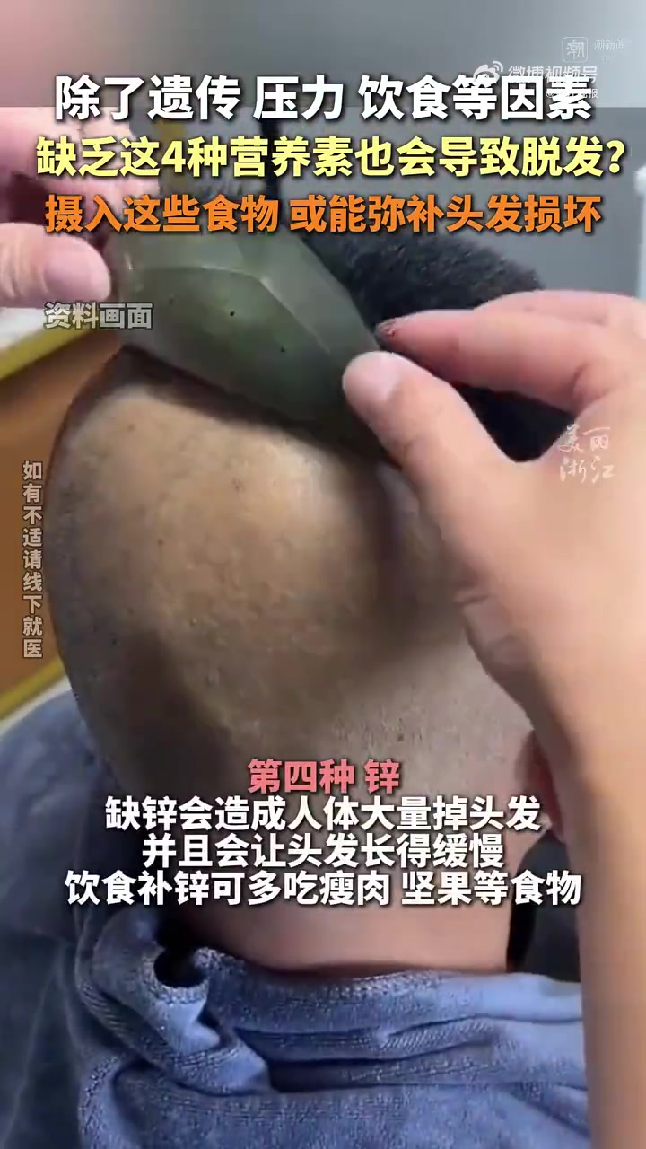 「2个月减肥30斤他瘦了也秃了」不到三个月,从200斤瘦到170斤,32岁的宁波小伙小周(