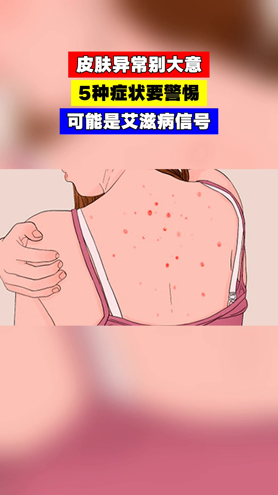皮肤异常别大意，5种症状要警惕，可能是艾滋病信号