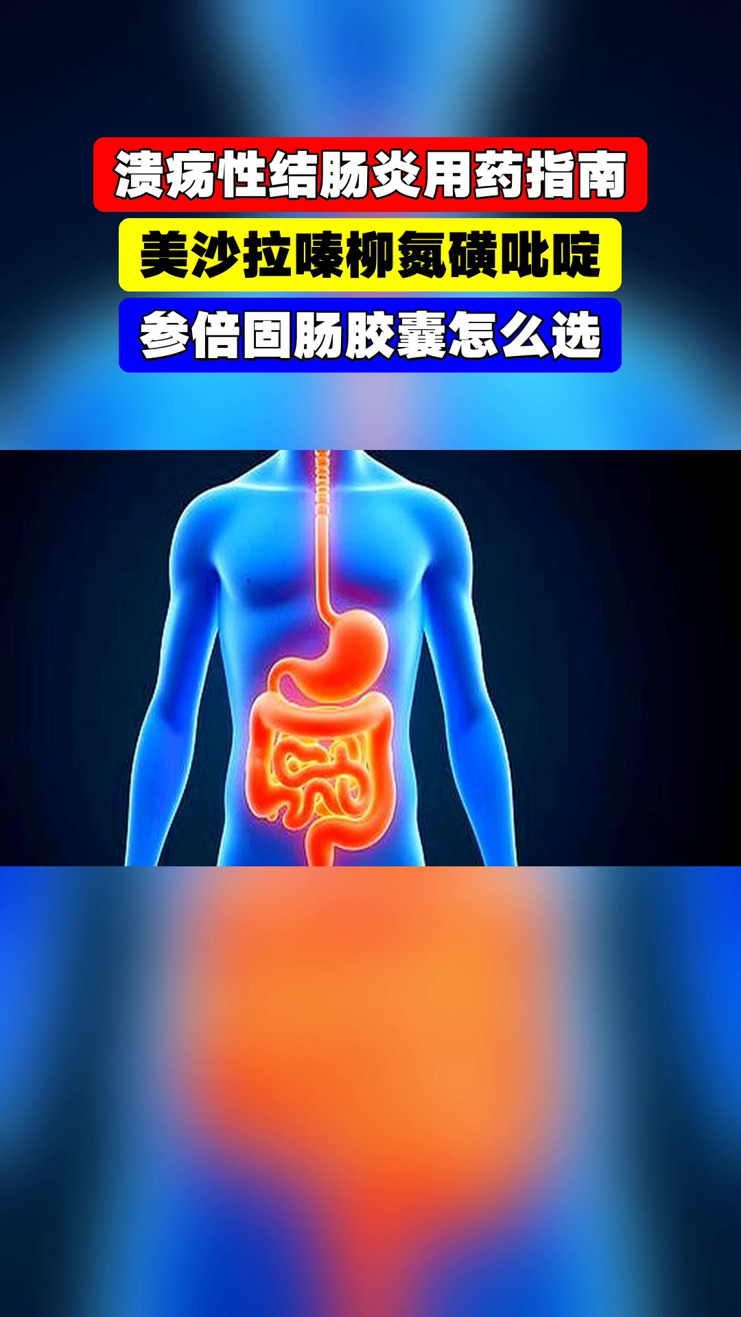 溃疡性结肠炎用药指南，美沙拉嗪柳氮磺吡啶，参倍固肠胶囊怎么选