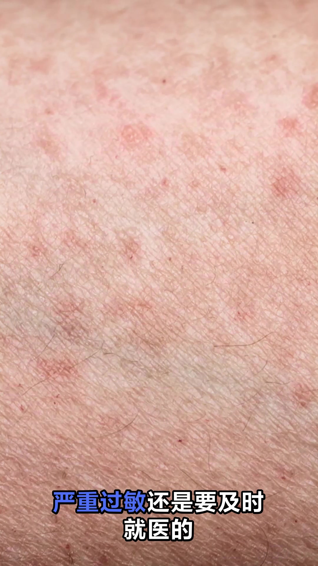 苣荬菜的神奇功效与作用揭秘