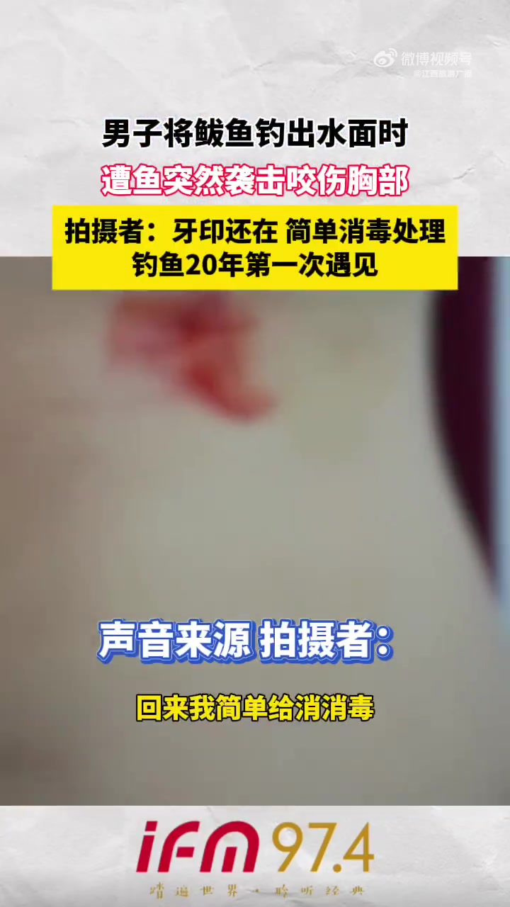 男子将鲅鱼钓出水面时，遭鱼突然袭击咬伤胸部，拍摄者：压印还在，简单消毒处理，钓鱼20年第一