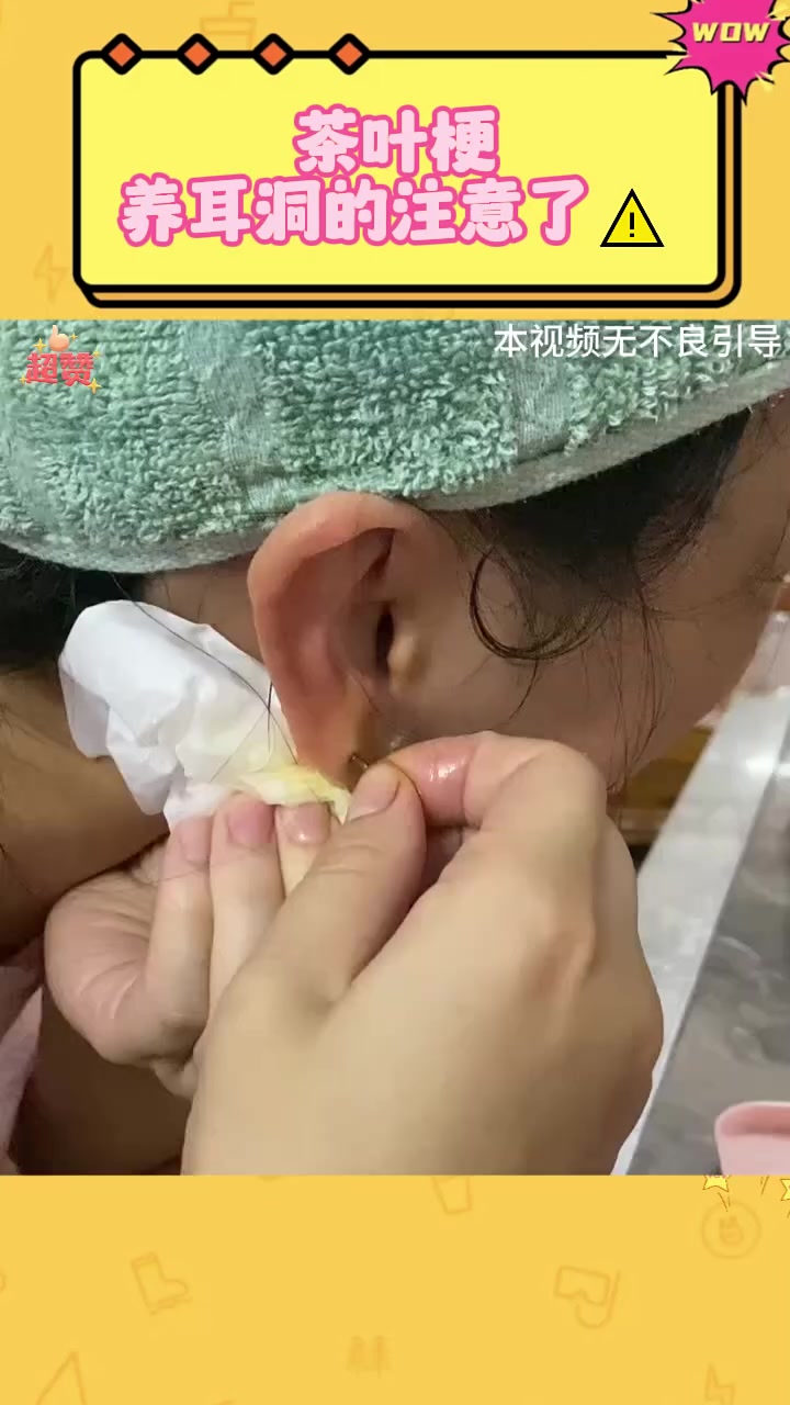 茶叶梗养耳洞的注意了