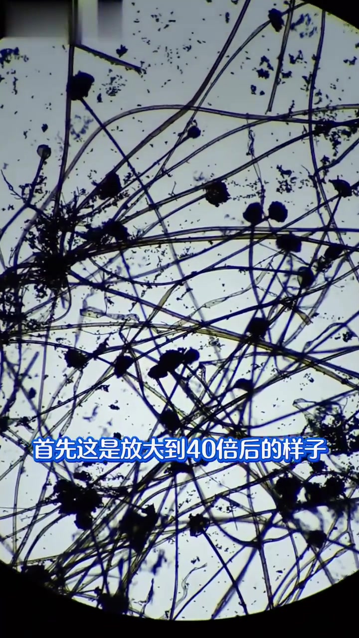 微观世界大冒险,带你看清豌豆上的小黑毛。梅豆发霉放大400倍