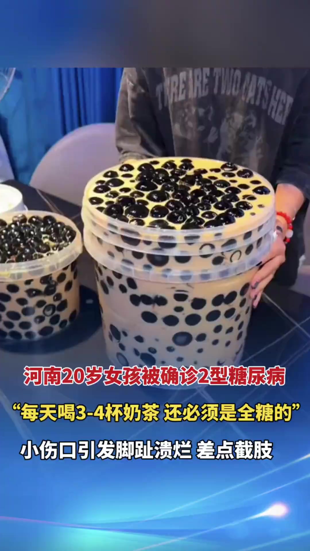 20岁女孩天天喝奶茶脚趾险截肢 河南20岁女孩每天喝3-4杯奶茶，“还必须是全糖的，不带糖