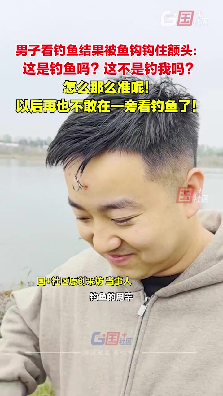 10月18日，陕西西安。男子看钓鱼结果被鱼钩钩住额头：这是钓鱼吗？这不是钓我吗？怎么那么准