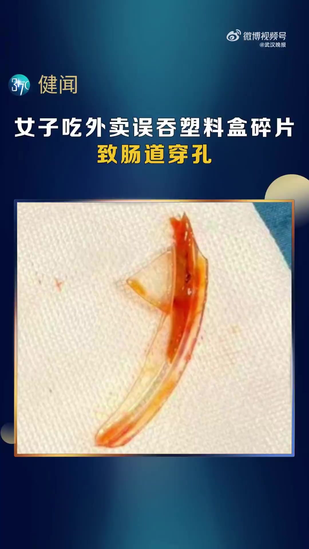 近日,武汉57岁的李女士因误吞混入外卖汤中的塑料打包盒碎片导致小肠穿孔。经急诊手术,取出长
