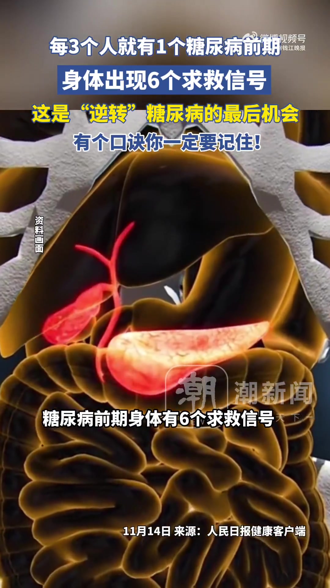 「糖尿病前期身体有6个求救信号，这是“逆转”糖尿病的最后机会，你一定要早点知道！」数据显示