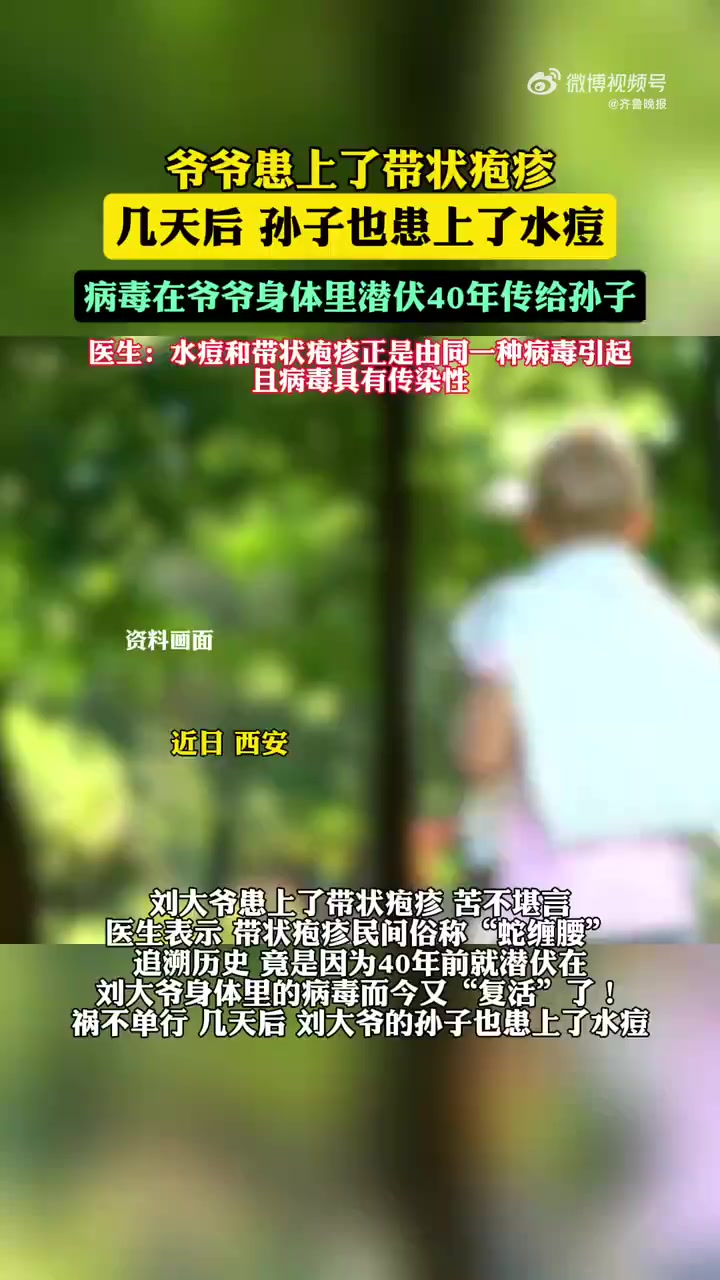 近日,陕西西安。家住幸福社区的刘大爷患上了爱折腾老人、让人“疼到崩溃”带状疱疹,苦不堪言。