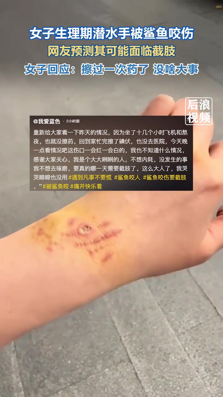 女子生理期潜水被鲨鱼咬伤，伤口感染网友预测其可能面临截肢