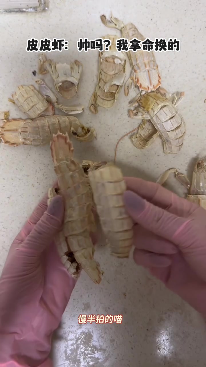 皮皮虾:帅吗,我拿命换的!