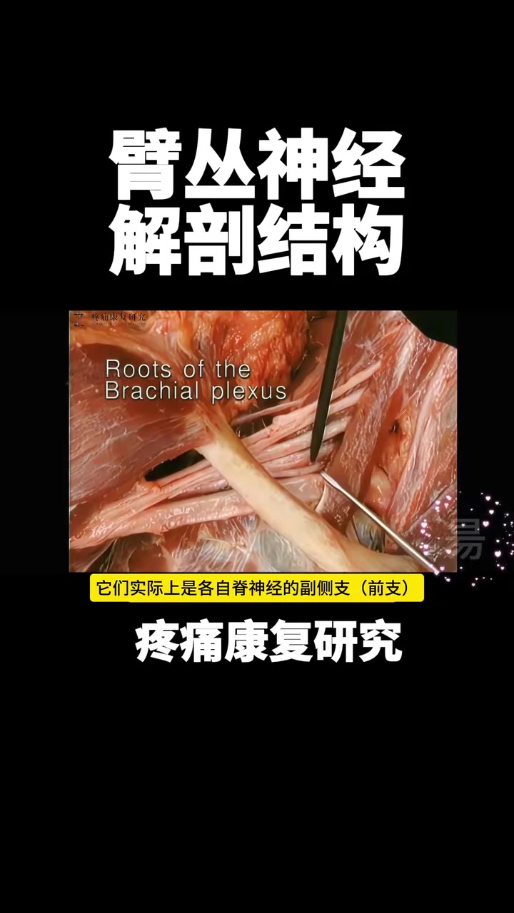 臂丛神经解剖结构