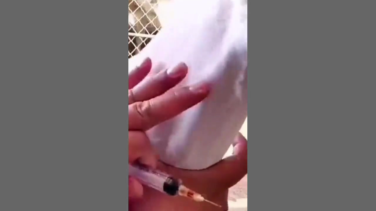 牛羊很多疾病打肌肉针不管用了,要静脉来急救,看完这视频就会了
