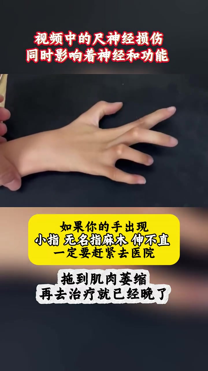 你也有这种情况吗？尺神经损伤 手外科