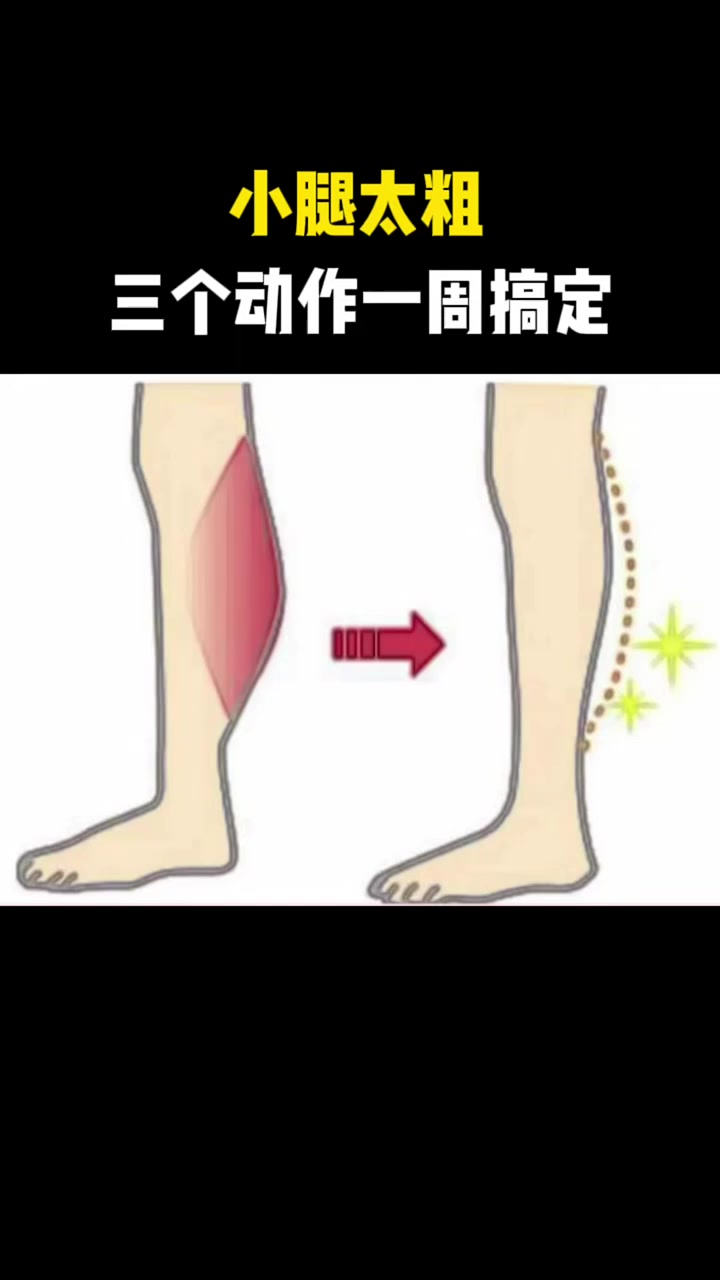 在粗的小腿也能瘦下去,三个动作,一周瘦掉小腿赘肉,美化小腿线条!