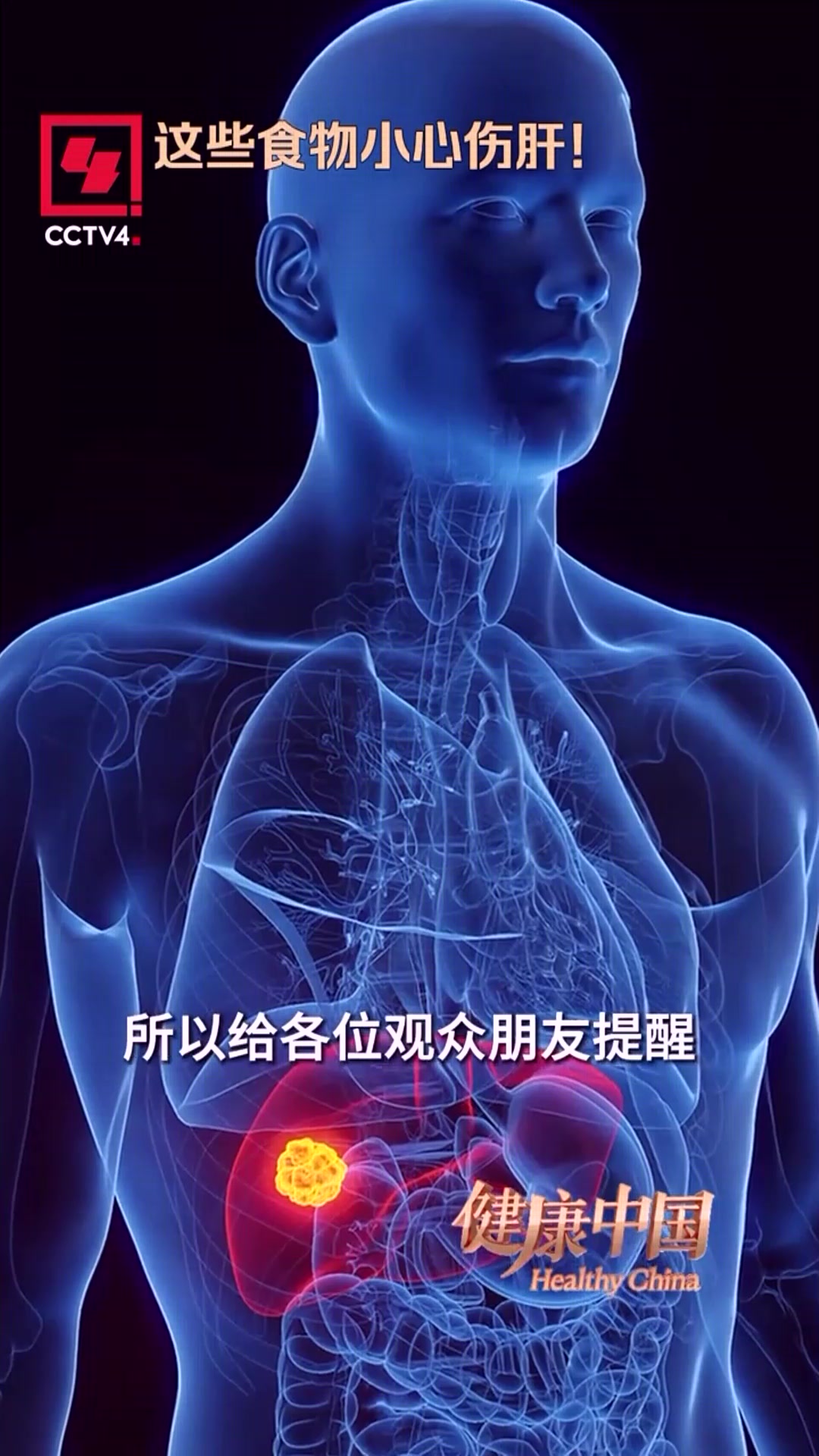 生吃醉虾、醉蟹，小心感染肝吸虫！医生郑重提醒：千万别为了一口“鲜”，生吃食物