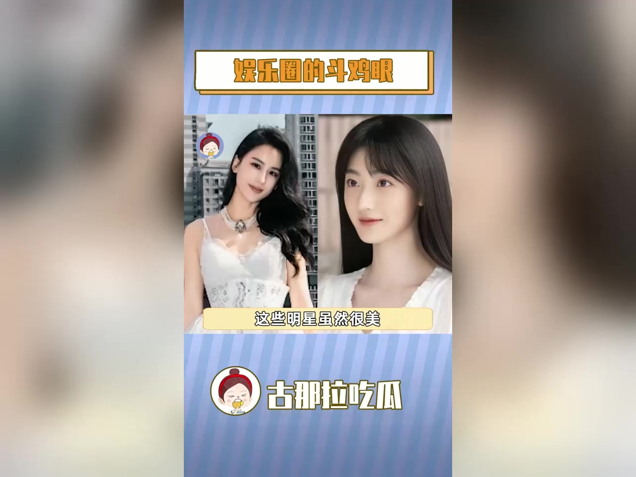 娱乐圈有斗鸡眼的明星