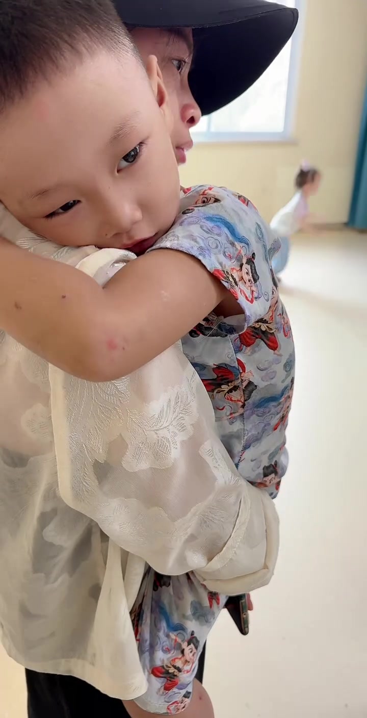 3岁宝宝持续补AD和D，仍有鸡胸肋骨高，医生建议多晒太阳