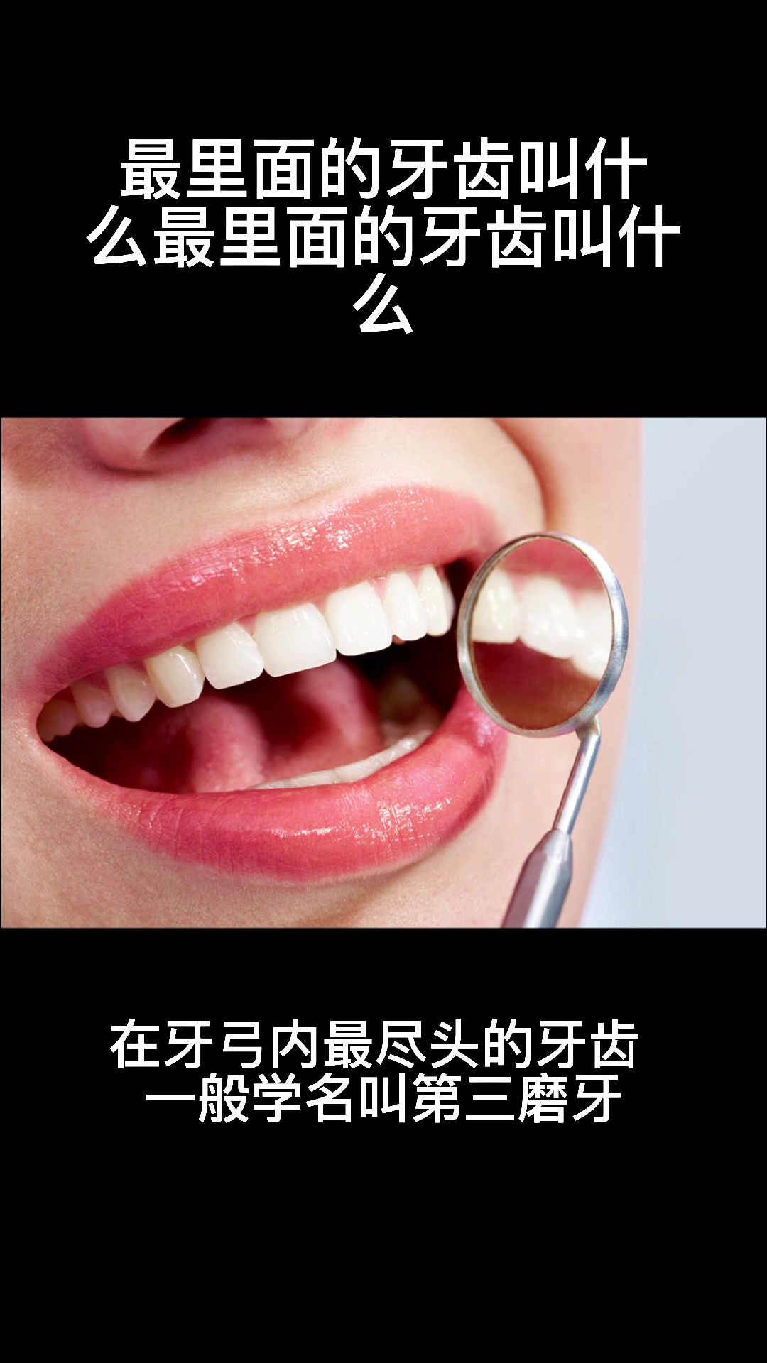 最里面的牙齿叫什么
