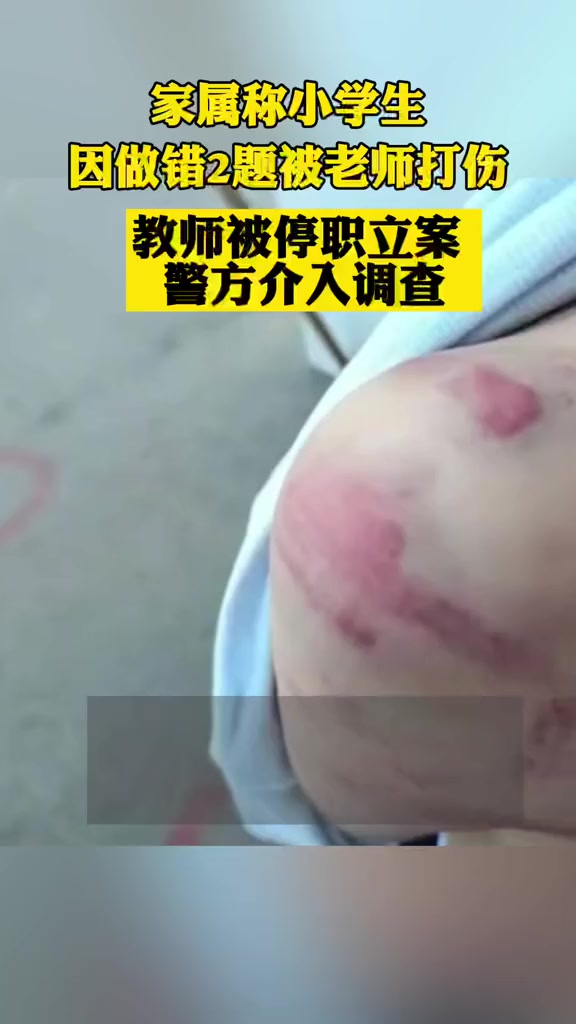 重庆体罚小学生教师被停职立案警方介入调查
