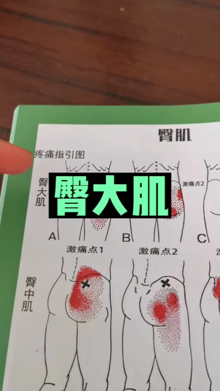 肌肉疼痛查询手册五月大哥讲肌肉臀大肌尾骨痛