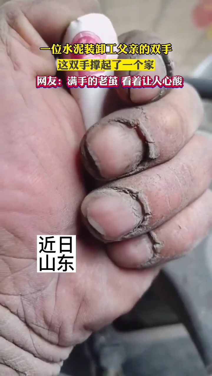 一位水泥装卸工父亲的双手,满手的老茧看着让人心疼.看哭了 父亲 泪目