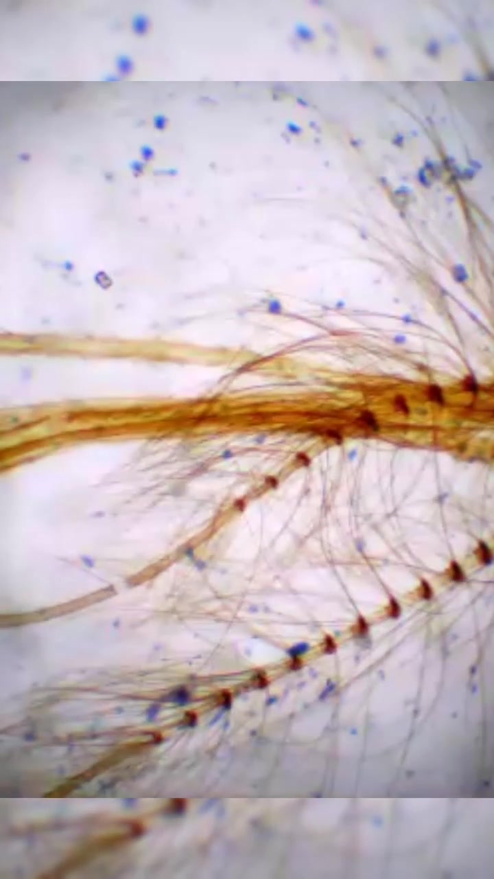 第108集|蚊的环毛状触角及刺吸式口器 好奇科学 生物 显微镜下