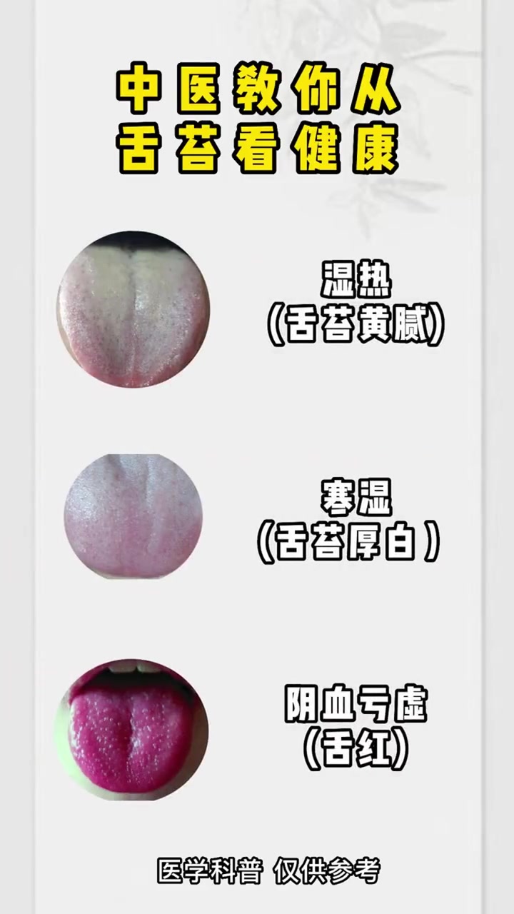 中医 舌诊 看的是什么你知道吗?-度小视