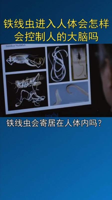 铁线虫进入人体,真的很恐怖吗-度小视