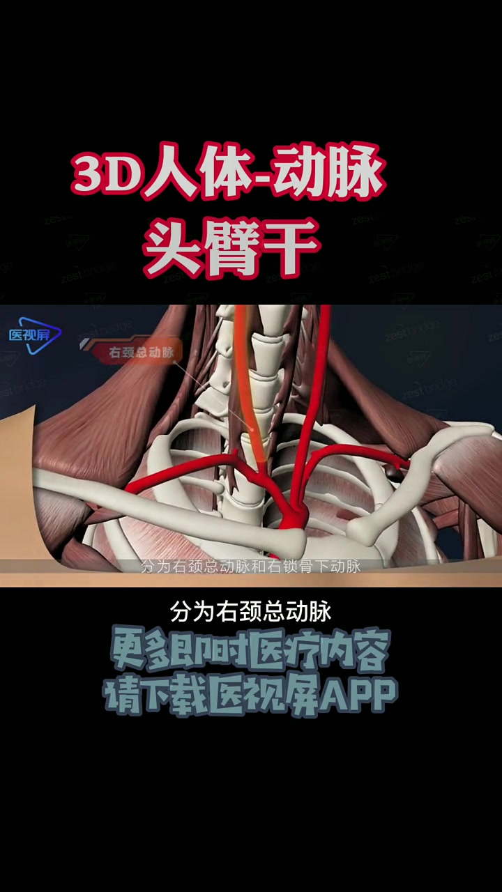 这是头臂干,从升主动脉弓发出,向右上方斜行,到右