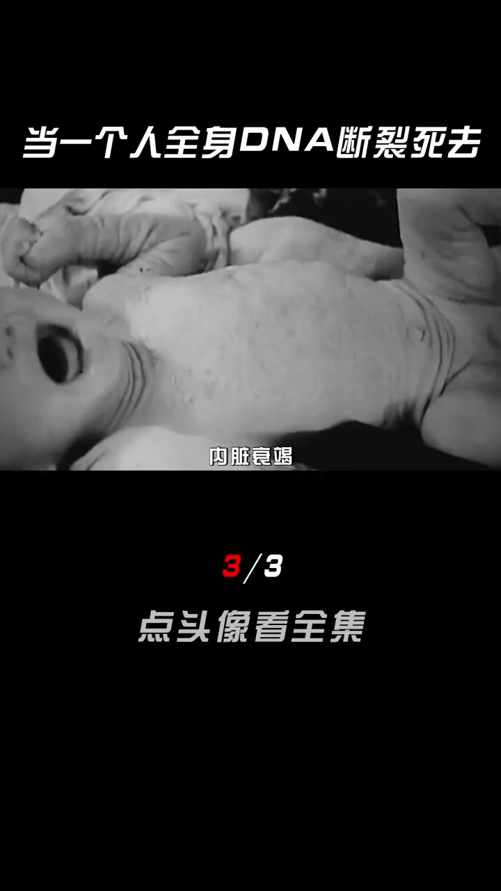 揭秘真实核辐射案例(3/3)科普一下 涨知识 大内久