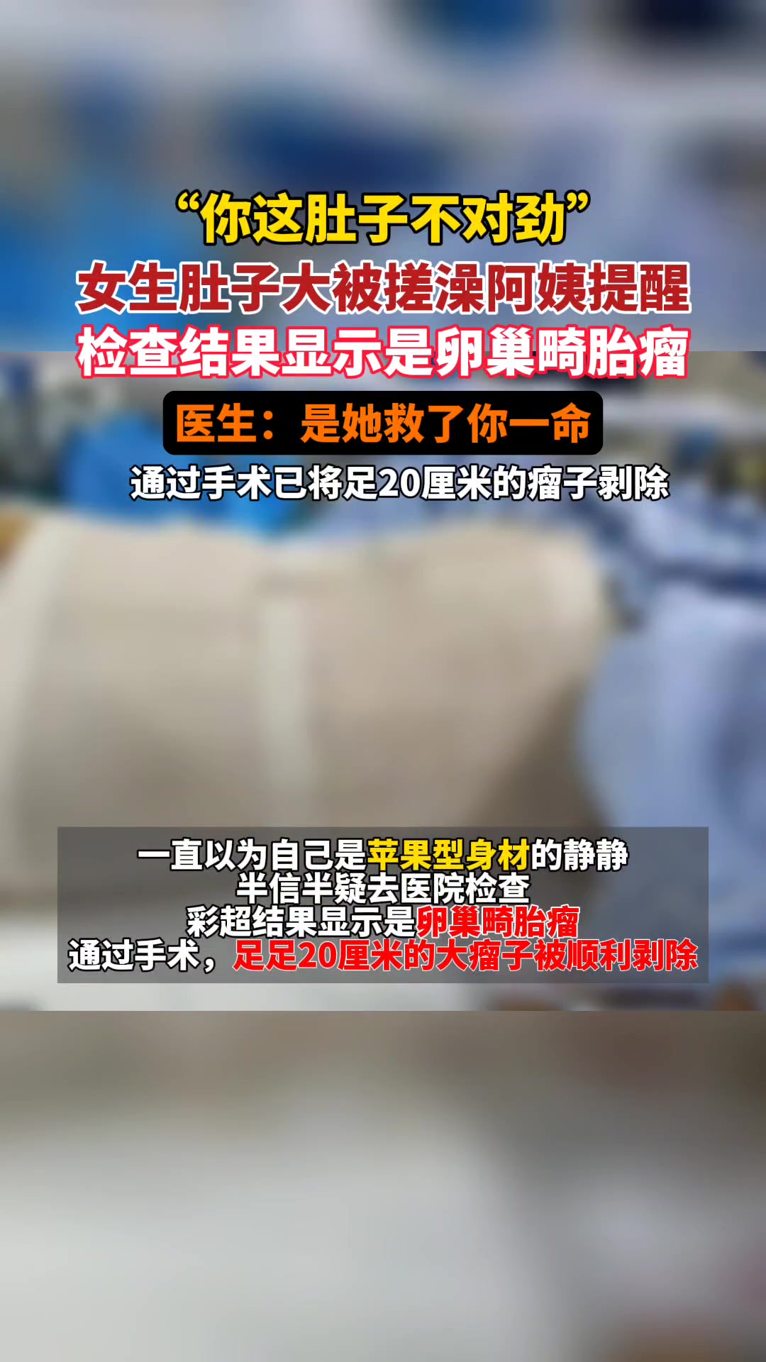 女生肚子大被搓澡阿姨提醒,检查结果显示是卵巢畸胎瘤,医生:是她救了