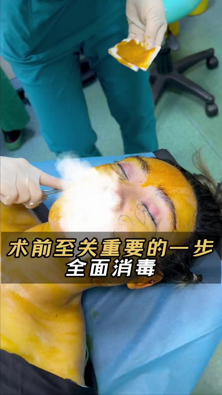 手术前至关重要的一步,全面消毒 蒋亚楠面部提升