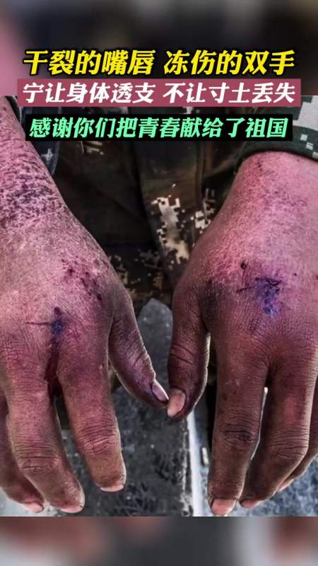 (编辑:余佳豪)高原战士 高原反应 中国军人-度小视