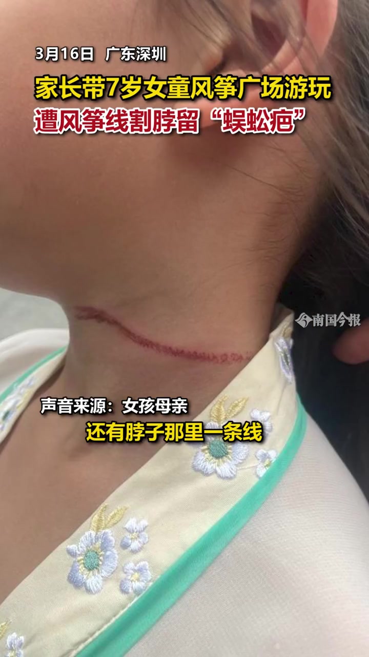 广场游玩 遭风筝线割脖留"蜈蚣疤" 风筝线很危险 风筝线伤人-度小视