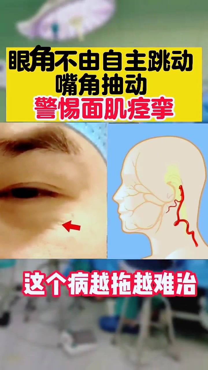眼老是跳,不由自主的,嘴角还抽,警惕面肌痉挛!