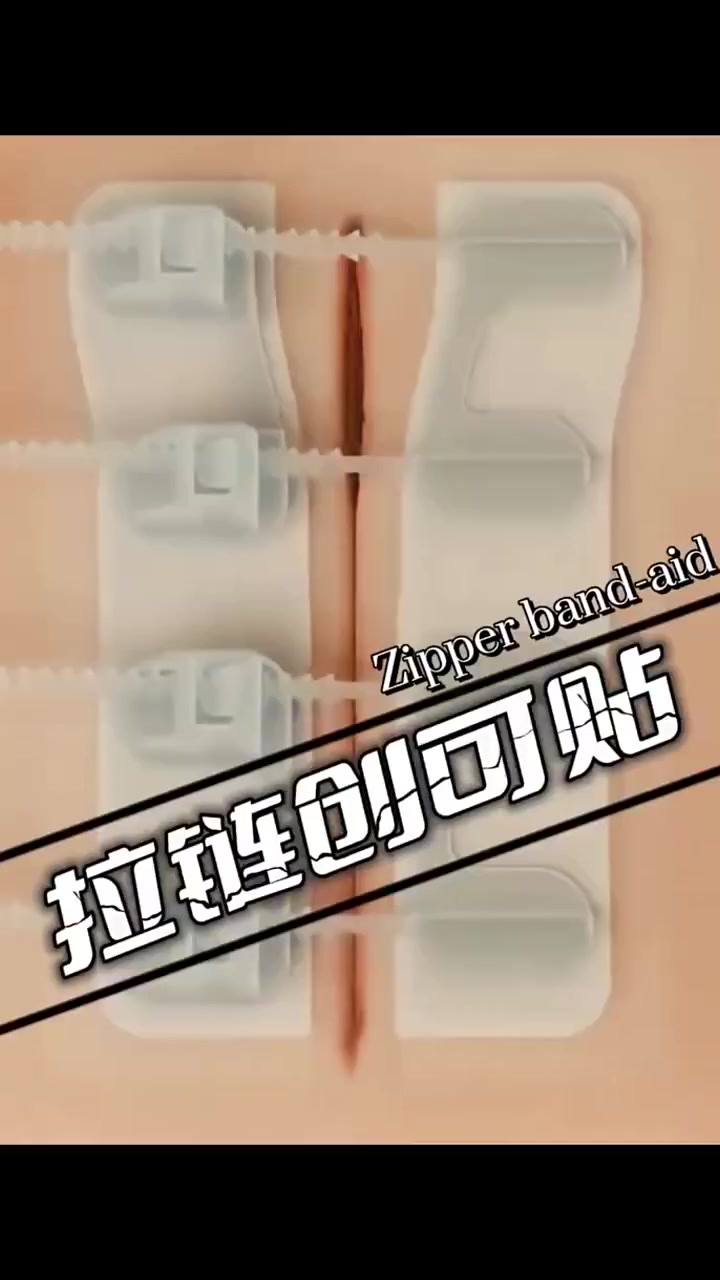 神奇的拉链式创可贴