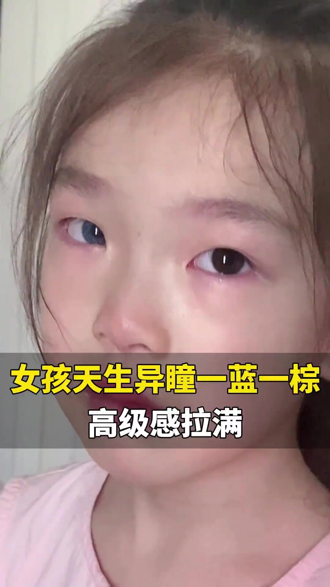 女孩天生异瞳被赞眼睛里有星辰大海