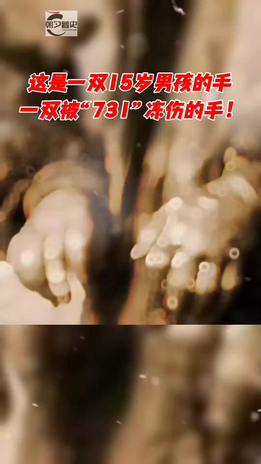 被731部队冻伤的小手!一个15岁男孩被放进冰柜里,没一会儿