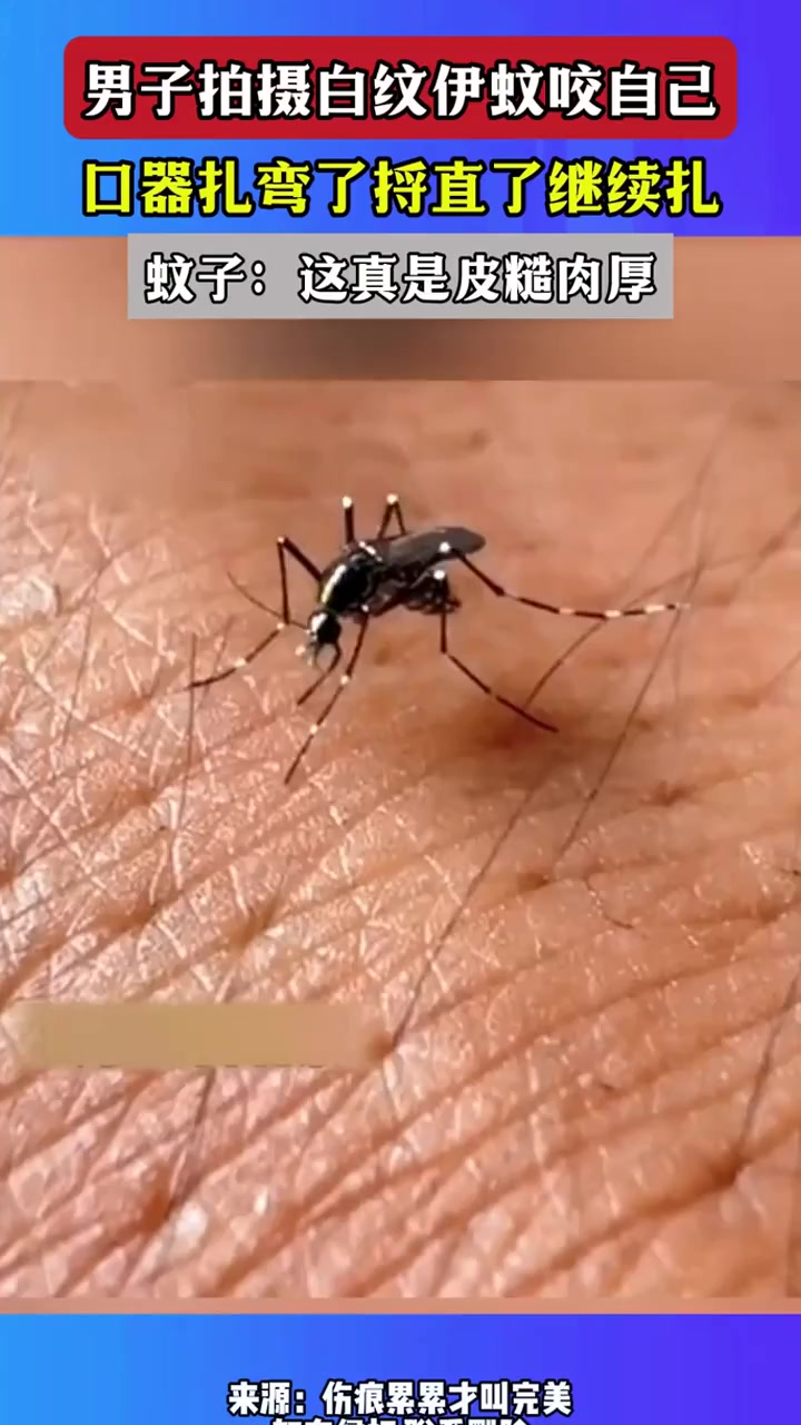 男子拍摄白纹伊蚊咬自己,口器扎弯了捋直了继续扎蚊子:这真是皮糙肉厚