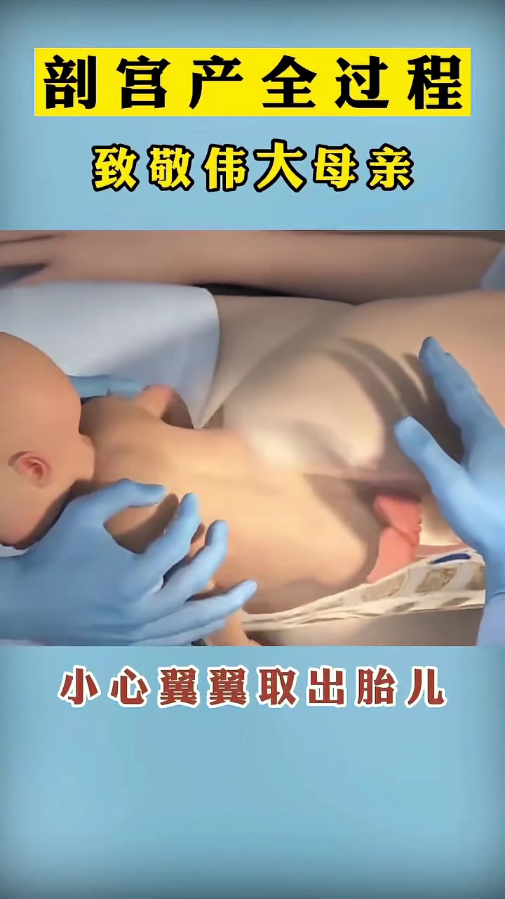 3d动画看剖宫产全过程,致敬每一位妈妈