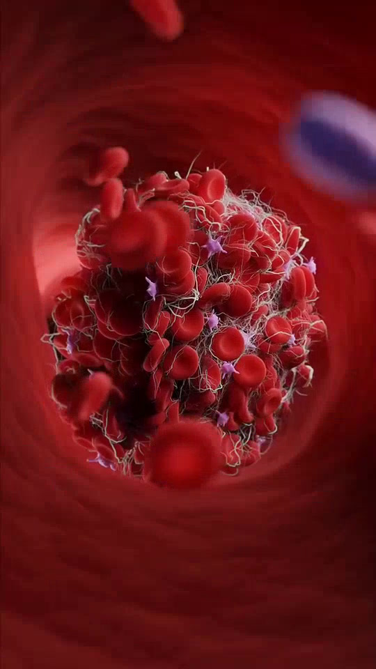 血液为何会凝结?