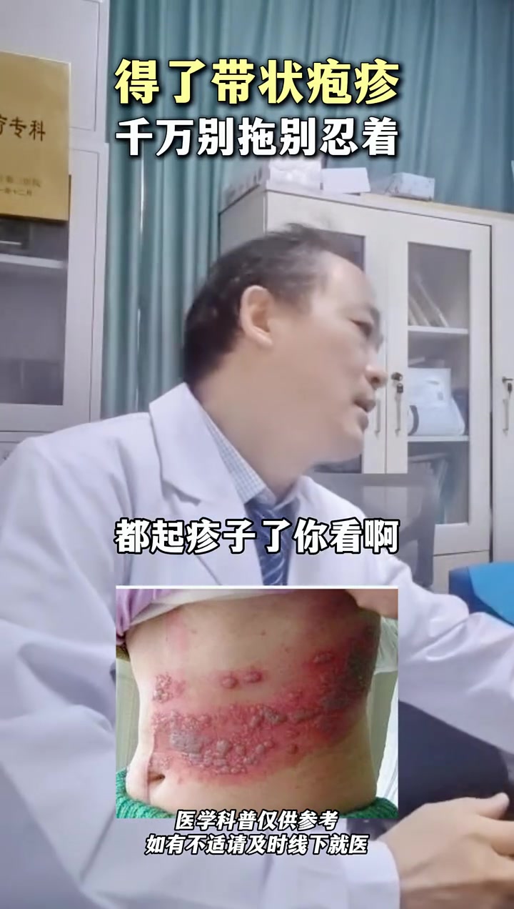 得了蛇缠腰,千万别拖