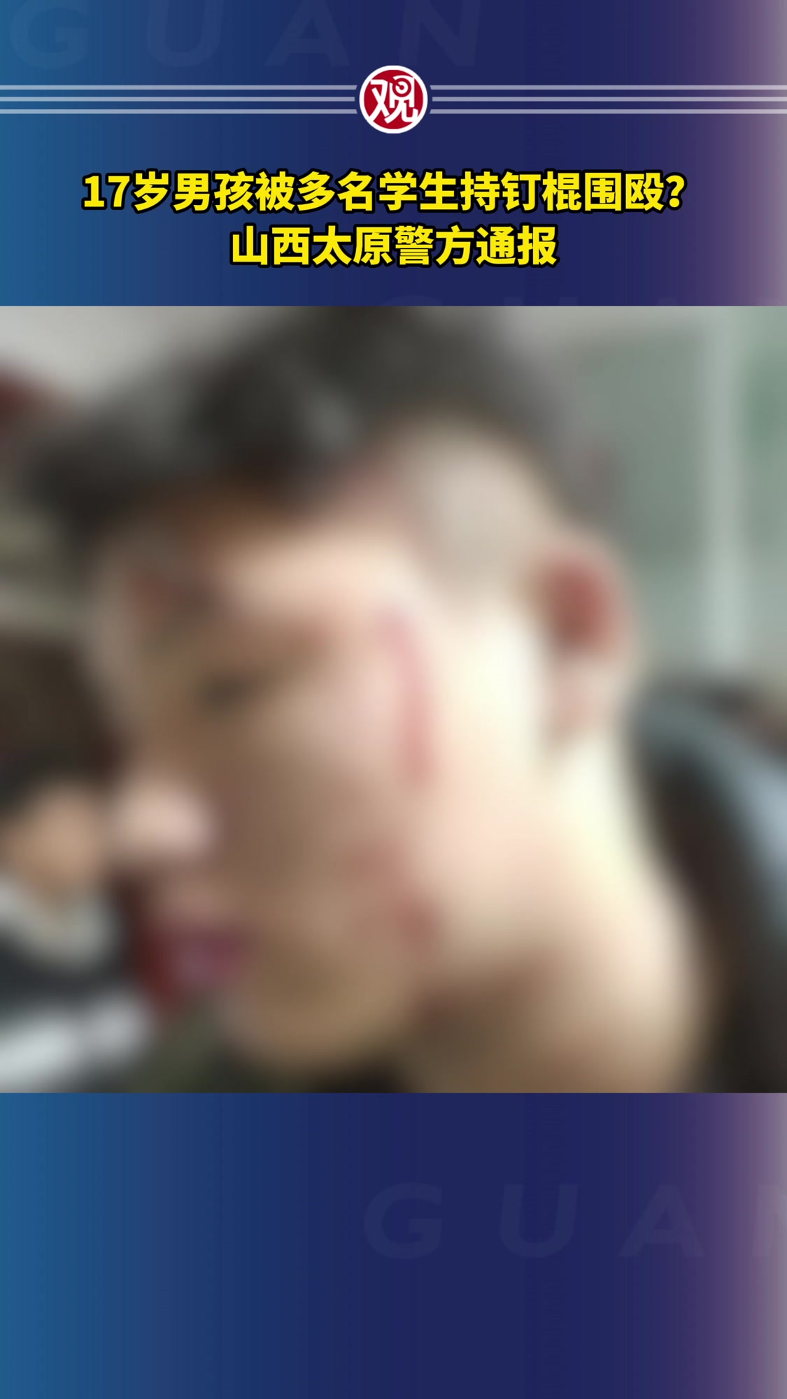17岁男孩被多名学生持钉棍围殴?山西太原警方通报
