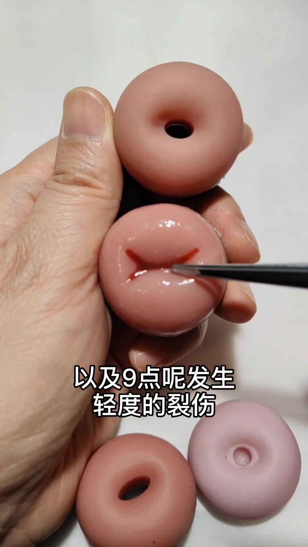 生过孩子的宫颈是这样的