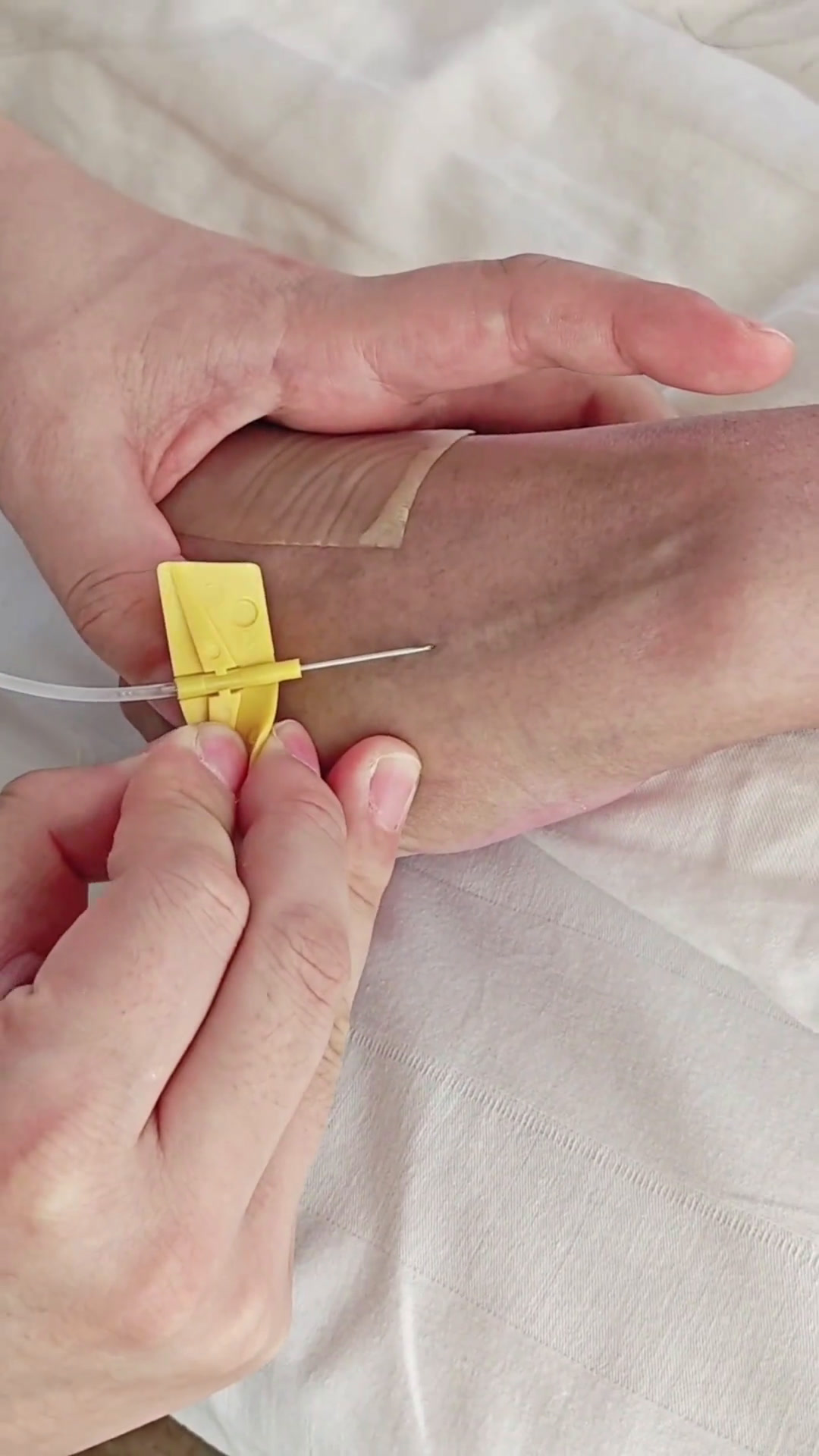 分享日常扎针护士留置针