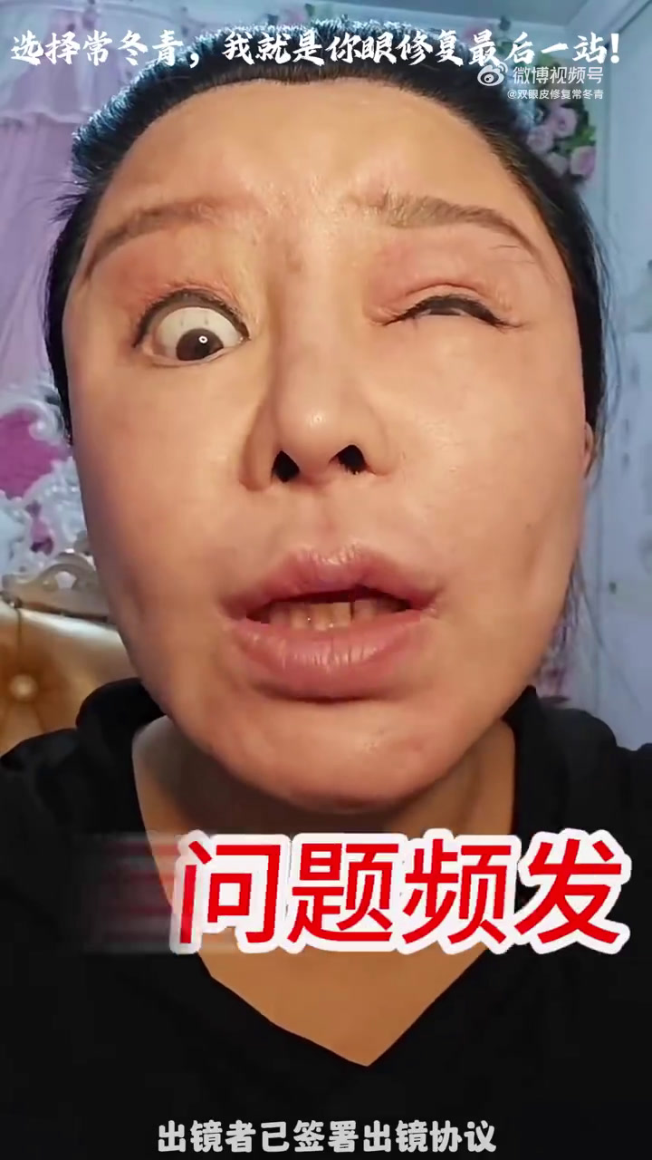 韩式无痕,纳米无痕,微创眼综合,这些双眼皮技术是真实存在的吗?