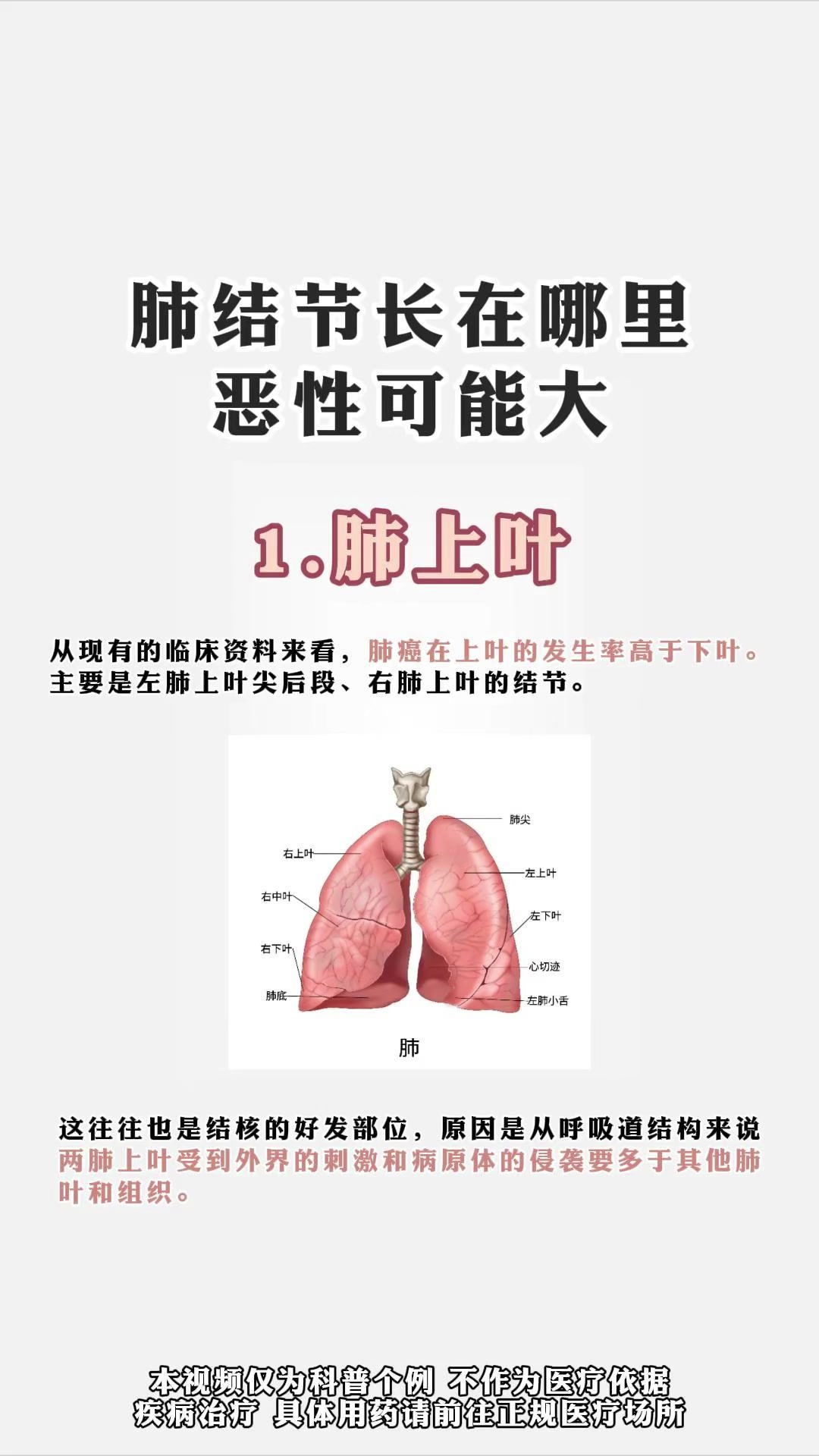 肺结节长在哪里恶性程度大